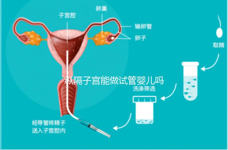 縱隔子宮能做試管嬰兒嗎?醫(yī)生:可以做，但要手術(shù)治療再進周