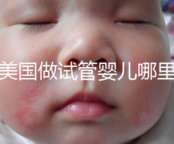 去美國(guó)做試管嬰兒哪里最好,4家好評(píng)輔助生殖機(jī)構(gòu)推薦