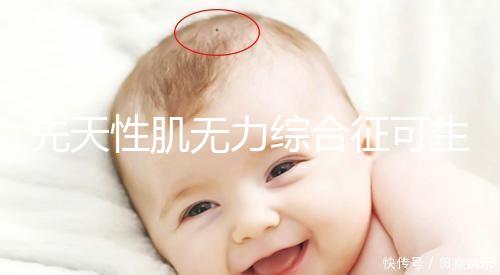 先天性肌無力綜合征可生育嗎？能做試管避免遺傳？