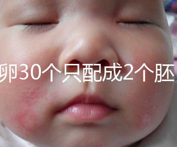 取卵30個只配成2個胚胎別放棄！卵巢傷口小移植成功率不低