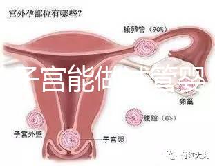 雙角子宮能做試管嬰兒嗎？可以，但這2大條件缺一不可