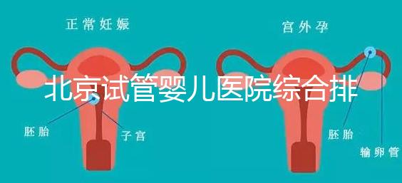 北京試管嬰兒醫院綜合排名比較完美的有哪幾個