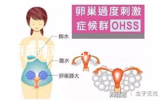 唐氏篩查最好時間是什么時候，內蒙古單項費用不超三百