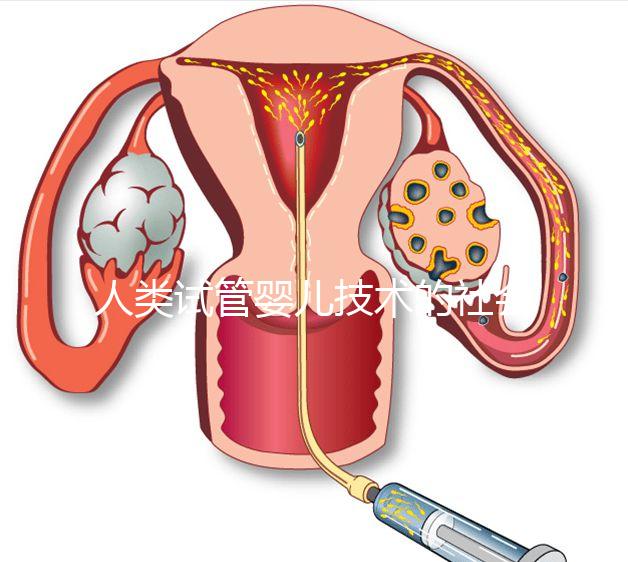 人類(lèi)試管嬰兒技術(shù)的社會(huì)價(jià)值