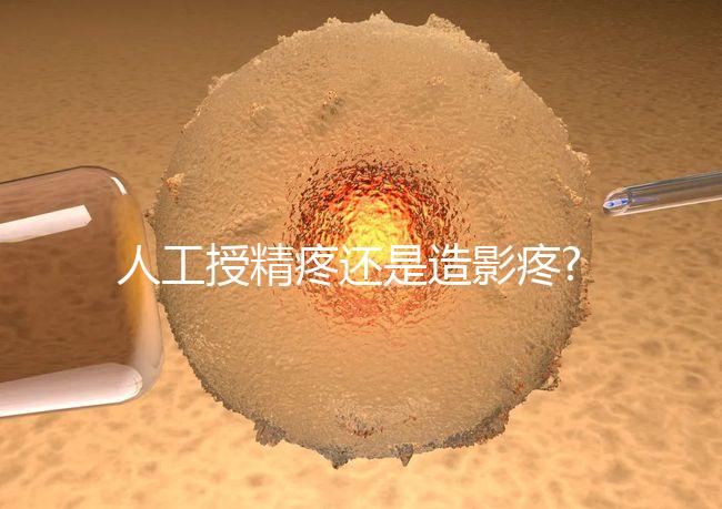 人工授精疼還是造影疼?被瞎對比，二者疼痛不是一個等級