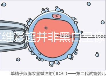 二維彩超并非黑白呈像，通過檢查還能看清胎兒五官