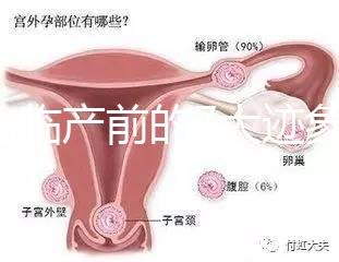 二胎臨產(chǎn)前的7大跡象，出現(xiàn)見紅、陣痛別大意