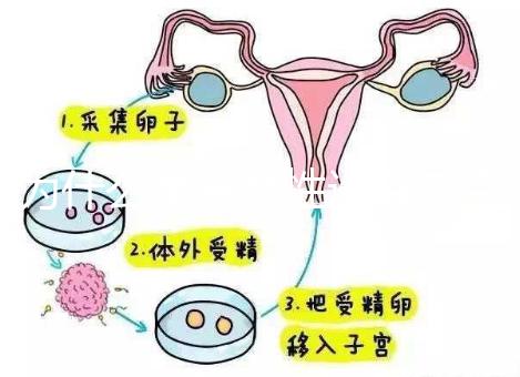 為什么單身女性選擇烏克蘭MINI醫院試管嬰兒？詳細分析三個原因