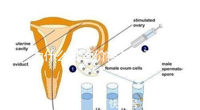 為什么試管價(jià)格差異那么大?做試管到底要花多少錢?