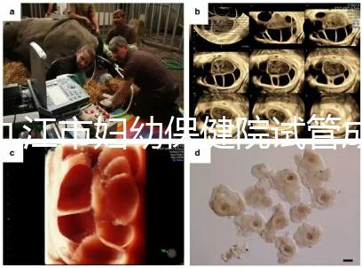 九江市婦幼保健院試管成功率高、費用低？生殖醫生揭開真相