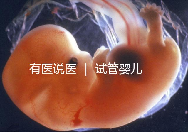 有醫(yī)說(shuō)醫(yī) | 試管嬰兒技術(shù)不能避免宮外孕,“三孩”時(shí)代警惕宮外孕發(fā)生率增加