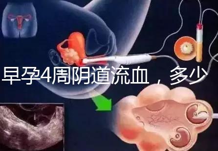 早孕4周陰道流血，多少天檢查血hcg或B超更穩(wěn)妥？