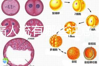 無痛人流有哪些注意事項？
