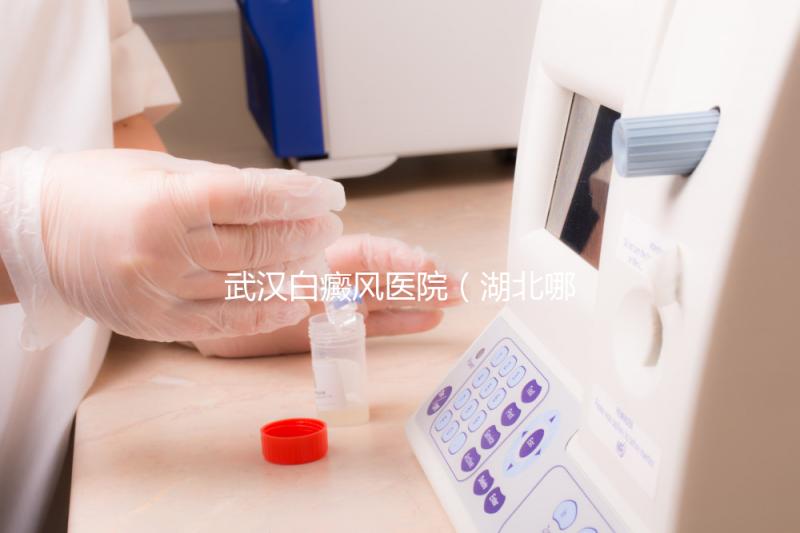 武漢白癜風醫院(湖北哪家醫院白癜風最好)
