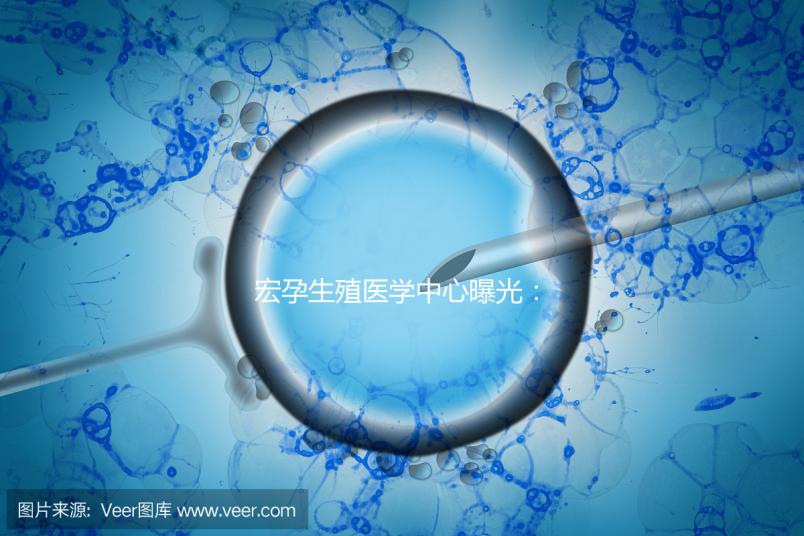 宏孕生殖醫學中心曝光:PGD成功率及適用人群