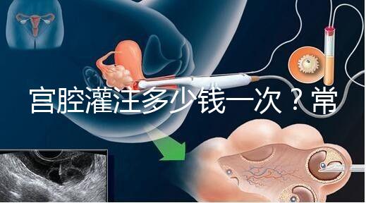宮腔灌注多少錢(qián)一次?常見(jiàn)疑問(wèn)匯總答疑