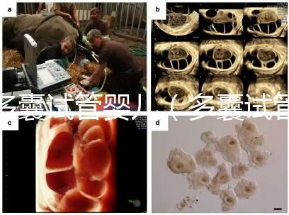 多囊試管嬰兒(多囊試管嬰兒成功率高嗎)