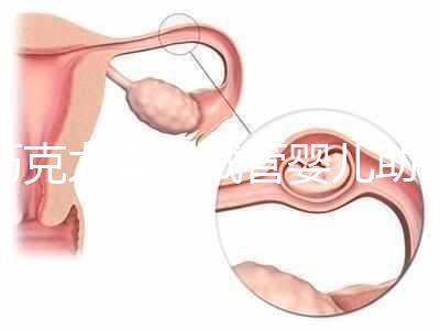巧克力囊腫試管嬰兒助孕應先治療?網(wǎng)友看法均有差異