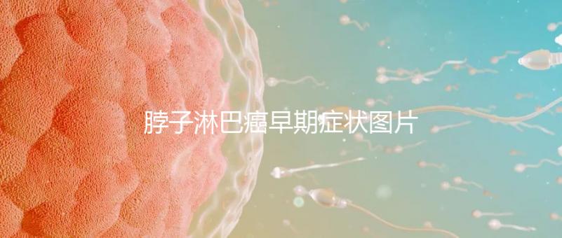 脖子淋巴癌早期癥狀圖片(脖子上有結(jié)節(jié)的圖片)