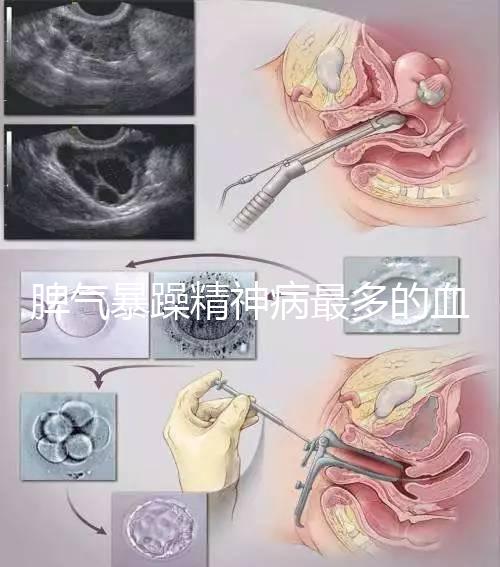 脾氣暴躁精神病最多的血型竟是…，4大血型隱藏了不同疾病
