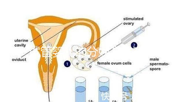試管嬰兒的分娩方式有哪些？能否自然分娩取決于情況