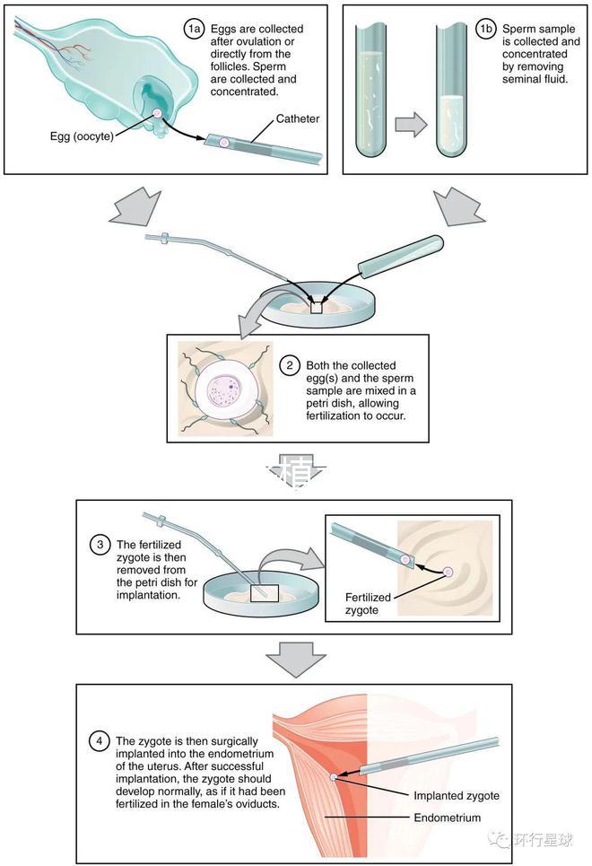試管嬰兒移植手術(試管嬰兒移植手術需要多長時間)