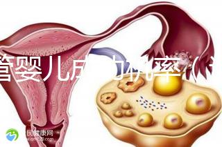 試管嬰兒成功機率(試管嬰兒成功機率有多少)