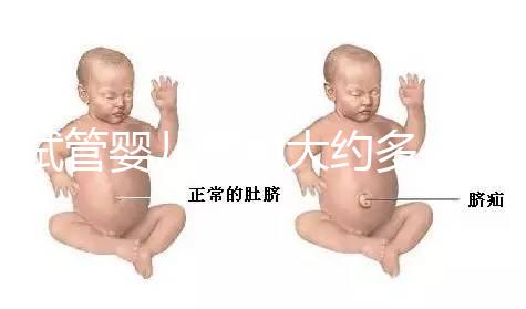 試管嬰兒費用大約多少2021年:一二三代試管分別指的是什么?