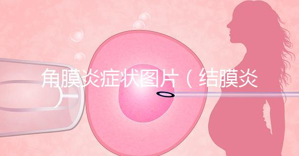 角膜炎癥狀圖片（結(jié)膜炎和角膜炎的區(qū)別）