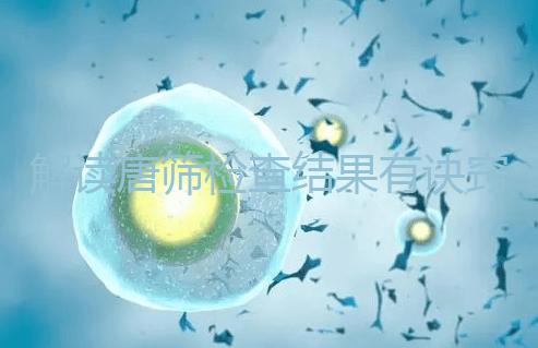 解讀唐篩檢查結(jié)果有訣竅，會看報告單上的正常值范圍是關(guān)鍵