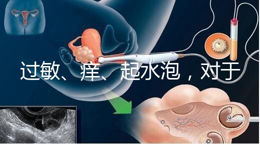 過(guò)敏、癢、起水泡,對(duì)于三伏貼的副作用你需知道該怎么辦