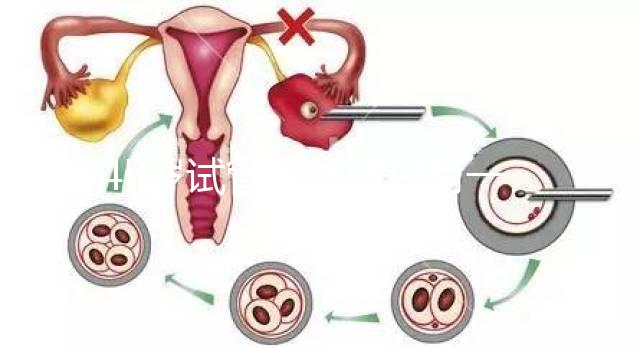 45歲試管促排卵只有一個卵泡不正常別數了我該怎么辦？