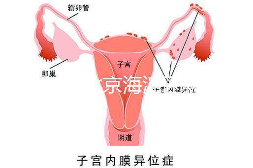 2024年北京海淀區(qū)新生兒醫(yī)療保險(xiǎn)處理策略，照片要求不要出錯(cuò)